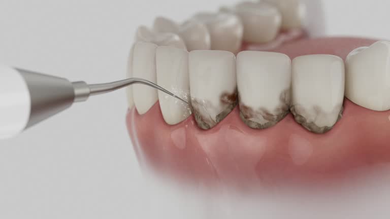 Trusted Teeth Cleaning And Checkup service in Anchor Point, AK - Dentist Open Now
